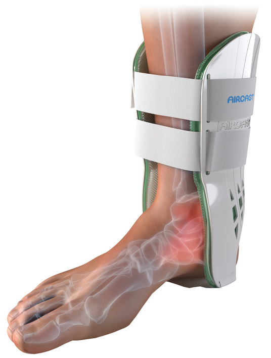 Orthèse de Cheville - Classique II - Gauche 