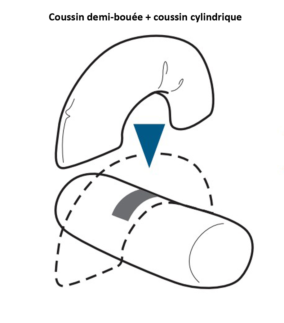 Coussin de Positionnement - Cylindrique - Microbilles 