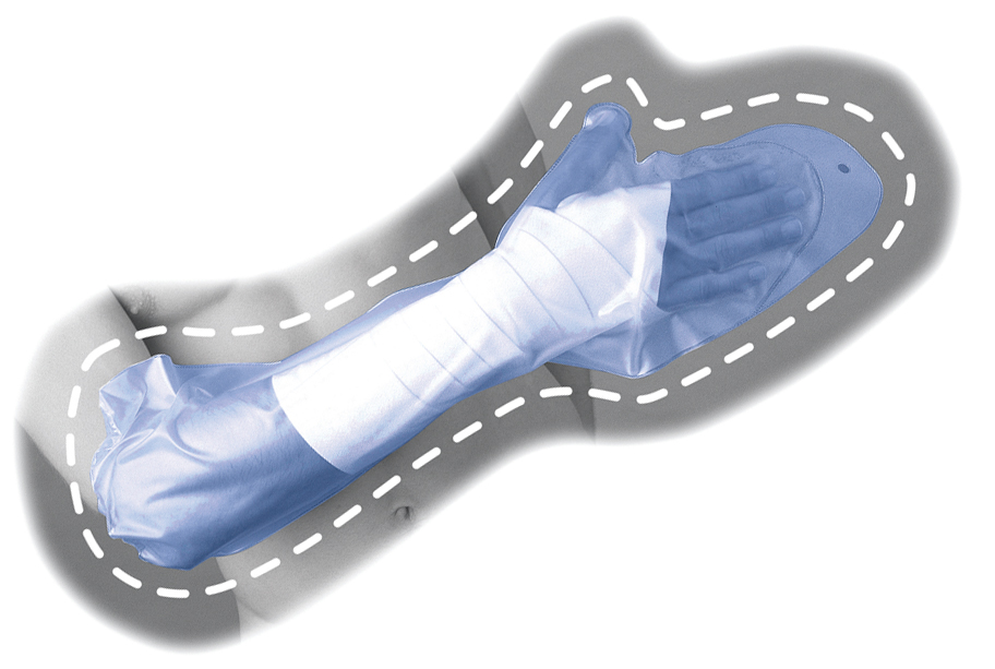 Housse De Protection - Membre  Supérieur  - Adulte ou Enfant